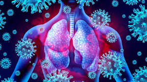 Please log in with your username or email to continue. Coronavirus Ibuprofen Tested As A Treatment Bbc News