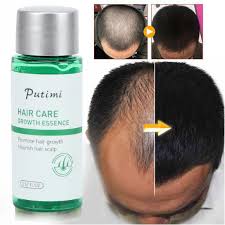 Get your pdf on charcoal detox. 20g Hair Growth Serum Hair Loss Treatment Hair Care Strengthen Liquid Buy From 5 On Joom E Commerce Platform