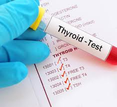 Image result for Thyroid Function Test
