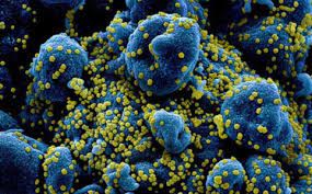 Jun 02, 2021 · bão cytokine ở giai này có thể xảy ra trên những cơ thể bị nhiễm trùng bởi tác nhân vi sinh mà cơ thể chưa có miễn dịch đặc hiệu với tác nhân này và đồng thời tác nhân gây bệnh cũng có đặc điểm nhân bản rất nhanh một khi xâm nhập vào cơ thể người bệnh. Vi Sao CÆ¡n Bao Cytokine Co Thá»ƒ Gay Tá»­ Vong á»Ÿ Bá»‡nh Nhan Covid 19