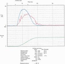 urodynamics the practical aspects springerlink