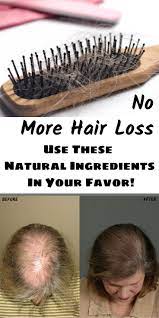 Aloe vera is a natural herbal remedy for hair loss. No More Hair Loss Use These Natural Ingredients In Your Favor Hair Loss Hair Loss Essential Oils Stop Hair Loss