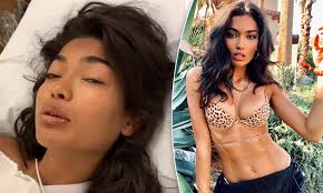 Victoria's secret model kelly gale, 26, is set for hollywood stardom as she announces … Kelly Gale Hilariously Rambles And Tries To Exercise In Post Surgery Videos Daily Mail Online