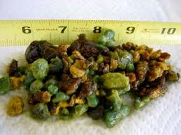 Pin On Gall Bladder Stones