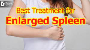 Enlarged Spleen Not Diagnosed And Untreated|Best Treatment Plan- Dr.  Ravindra B S|Doctors' Circle - Youtube