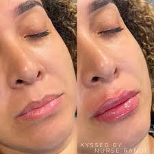 Hudson Valley Beauty Lab And Medi Spa In Newburgh NY