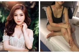 Gạo sen tách ra, cho vào ướp trà. Chá»©ng Bá»‡nh Khiáº¿n Ca SÄ© HÆ°Æ¡ng Tram Khá»'n Khá»• Nguy Hiá»ƒm Ä'áº¿n Má»©c Nao Tin Tá»©c Má»›i Nháº¥t 24h Ä'á»c Bao Lao Ä'á»™ng Online Laodong Vn