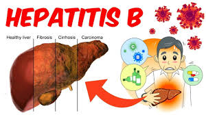 Pin On Hepatitis B Test Kits