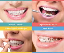 Pin On Teeth