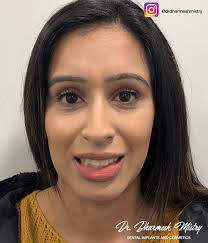 THE VB• 'Dr Dee, Here's a picture of my new smile! Thank you so much' One  of patients from Manchester who we have treated with complete replacement  dentures. That's right she has