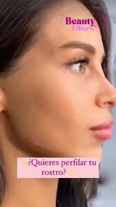 Aumento de menton, marcaje mandibular y perfilado, 🙌🏻, Logramos este  increíble resultado con 3 Jeringas de Ácido Hialurónico ✨💉, Paquetes para  este servicio con 3 Jeringas:, Marca Starfill $9,999, Lo ...