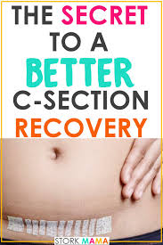 It can make your internal stitches pain after c section feel better and stretch more comfortably. C Section Scar Healing Care Guide Stork Mama