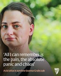 Dublin Zoo has announced the death of Leonie the Northwest Borean  orangutan. The zoo said Leonie, who was 44-year-old, was an “iconic  presence” since she arrived from Rotterdam Zoo in 1984. She