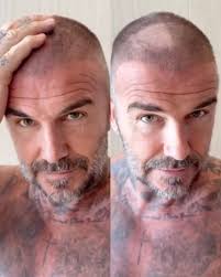 Greece and Panathinaikos defender George Baldock has died aged 31 😔💔