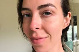 Wedding skincare routine: How I got my skin wedding ready in 6 months.