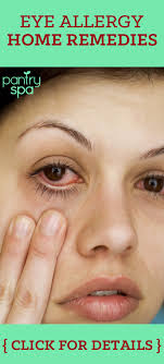 Eye Allergies Natural Remedies For Itchy Red Watery Eyes Allergy Eyes Allergy Remedies Itchy Eyes