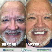 Braces/Aligners in New Port Richey