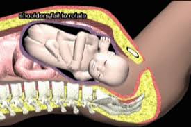 Image result for Compound Presentation