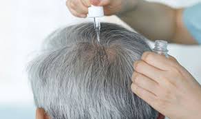 Biotin or b7 helps thicken your hair naturally and vitamin b5 (pantothenic acid) supports your adrenal glands. Hair Loss Treatment Five Of The Best Natural Oils To Stimulate Hair Growth Express Co Uk
