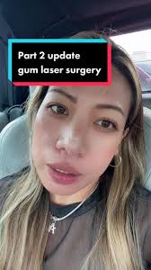 Why Is The Dennis Laser in My Gums