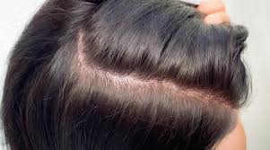 Ultimate Guide To Lightening Or Bleaching Hair At Home - Wonder Forest
