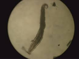 Image result for Pinworm