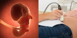 Kebutuhan pangan diutarakan secara naluri, bayi menangis pada saat lapar. Cara Kira Usia Kandungan Ini Yang Bakal Ibu Ayah Perlu Tahu Theasianparent Malaysia