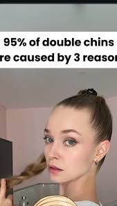 We tend to think that the reason for the double chin is fat., There is some  truth to that, but it’s only half of the picture., However, we also see  double chins