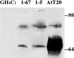 Proinsulin Endoproteolysis Confers Enhanced Targeting of Processed Insulin  to the Regulated Secretory Pathway