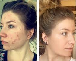 Pin On Beaute Et Sante