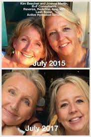 Melasma, known as the “Mask of Pregnancy” does not only occur in pregnant  women, but it can occur in all sorts of skin types, men and women. Learn  more