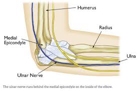 Entrapment occurs if this tunnel becomes too tight. Cubital Tunnel Syndrome Carolyn Yang Md