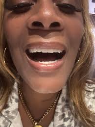 Dental work experience in Turkey