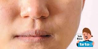 Cara mengatasi kulit wajah kering dan mengelupas perlu dilakukan apabila anda mengalami kulit wajah kering dan mengelupas yang disertai rasa perih, gatal, iritasi, dan kemerahan. Rekomendasi Rangkaian Skincare Yang Bagus Untuk Kulit Kering Tirto Id