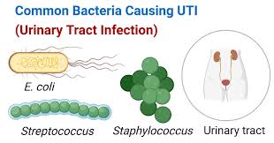 Common Bacteria Causing UTI (Urinary ...
