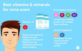 Vitamin a supplements for acne. Best Vitamin Supplements For Acne Scars Mdacne