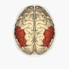 The dyslexic subjects had childhood histories of dyslexia and continued to show some. Dyslexia Wikipedia