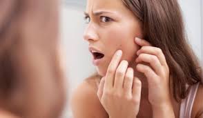 Acne Causes Prevention Et Traitement Des Boutons D Acne Doctissimo