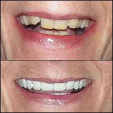 Expressions Dental Clinic in Candolim,Goa