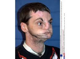 Les incroyables transformations de Richard Norris