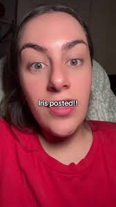 Iris Being Posted to Iris