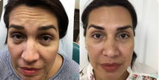 RealSelf: Aileen Caceres, MD, FACOG, FACS