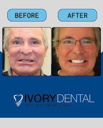 Meet Dr. Brody Hart the founder of Ivory Dental Arts and Implant Center.  Dr. Brody is fantastic at listening and taking the time with each of his  patients to make sure they