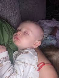 Turntable installation delayed due to surgery