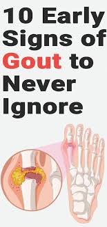 10 Early Signs Of Gout To Never Ignore Signs Of Gout Gout Remedies Inflammation Gout Remedies