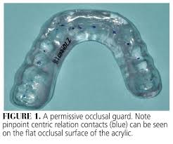 Image result for Occlusal