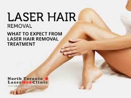 Laser hair removal is the application of laser light technology to remove body hair. What To Expect From Laser Hair Removal Treatment North Toronto Laser Med Clinic