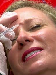 A shot to your beauty routine; Botox to prevent wrinkles
