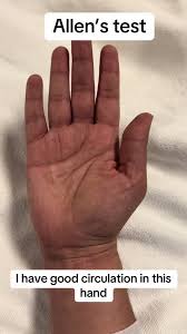 Image result for Allen Test