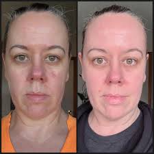 I get to spoil everyone with 35% off of a starter skincare regimen or a  refill regimen PLUS this black skincare travel case because I love you all  so much and want